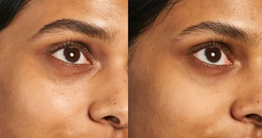 Post-Pandemic Self-Care: New Eye Balm Tackles Winter Skin Blues