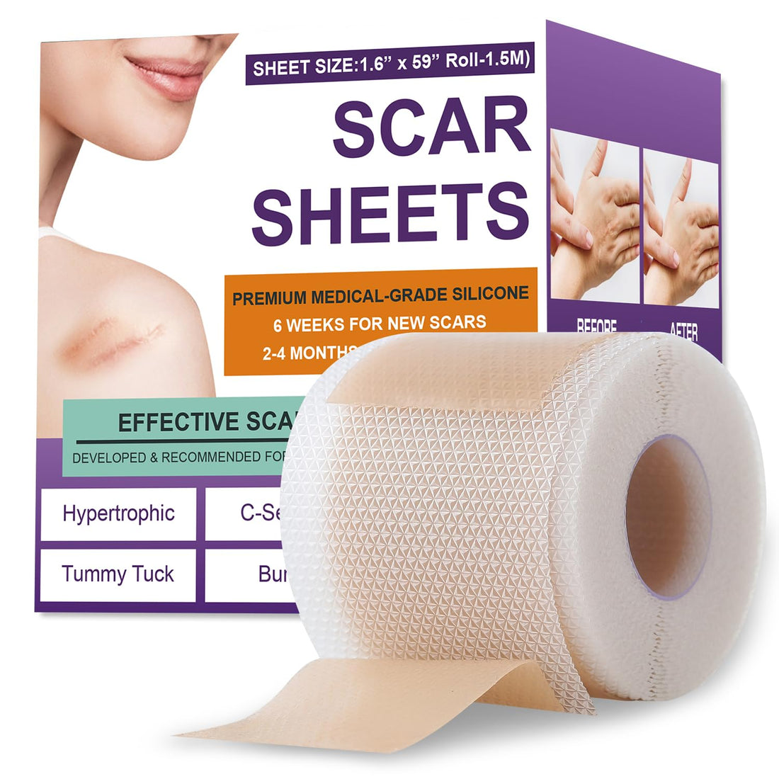 Minimizing Surgical Scars with Silicone Sheets and Adhesive Strips